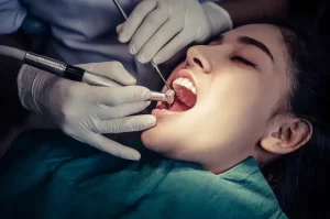 best dental clinic in brisbane